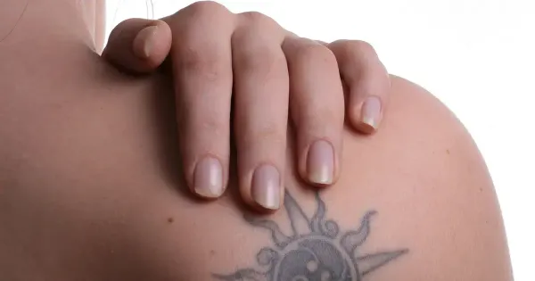 A tinta de tatuagem pode causar falência de órgãos e alergias